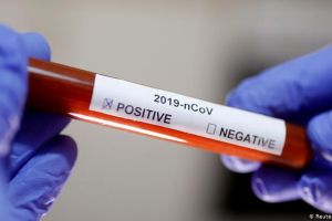 Кто в России стоит за производителями тестов на коронавирус